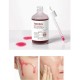 Esthetic House, Toxheal Red Glycolic Peeling Serum (100 мл), пілінг-сироватка для обличчя